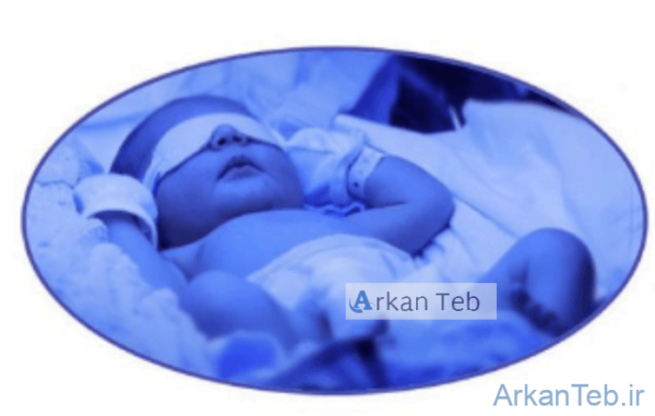 تصویر چشم بند فیتوتراپی نوزاد